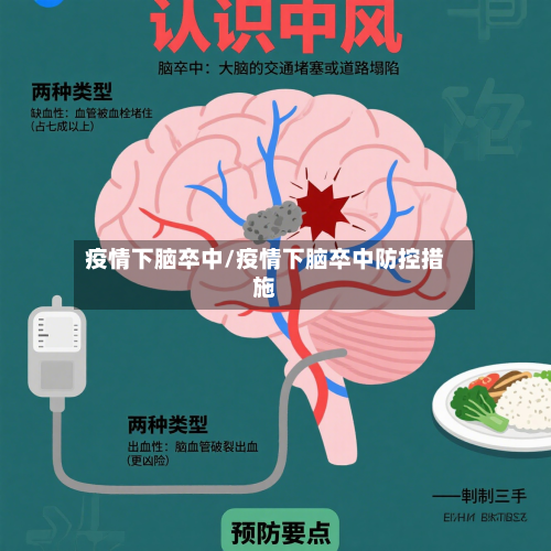 疫情下脑卒中/疫情下脑卒中防控措施