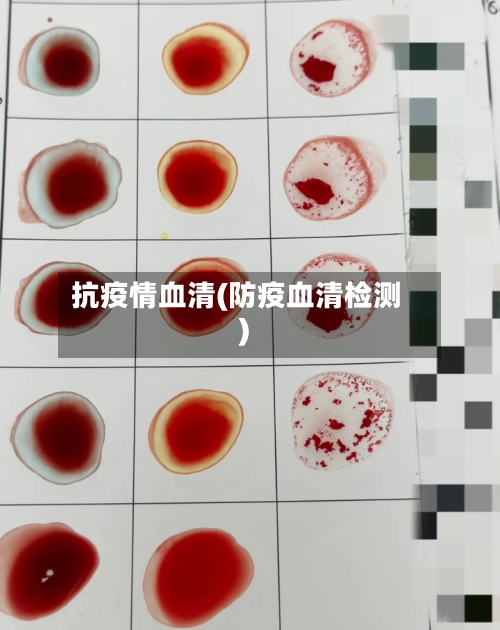 抗疫情血清(防疫血清检测)