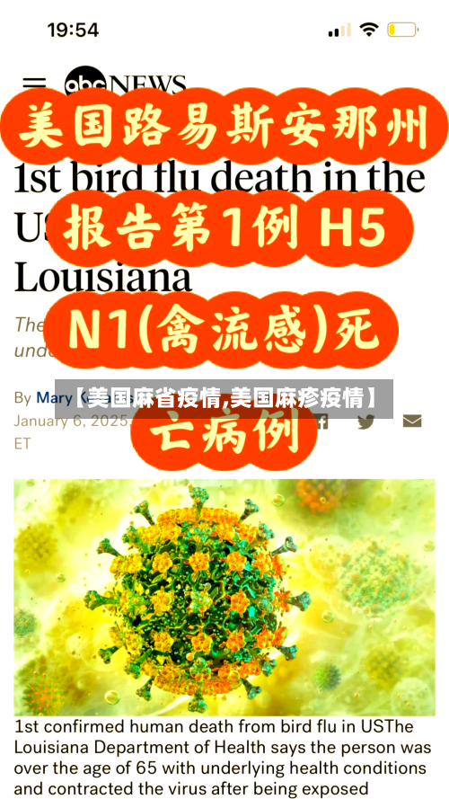 【美国麻省疫情,美国麻疹疫情】-第2张图片