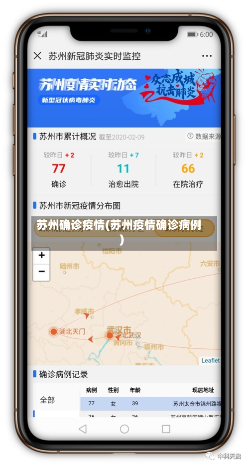 苏州确诊疫情(苏州疫情确诊病例)