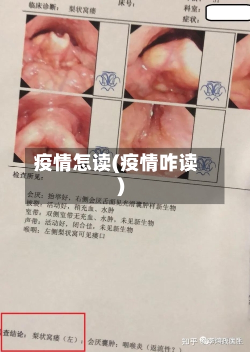 疫情怎读(疫情咋读)-第2张图片