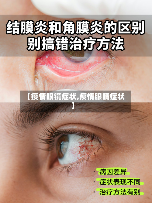 【疫情眼镜症状,疫情眼睛症状】-第2张图片