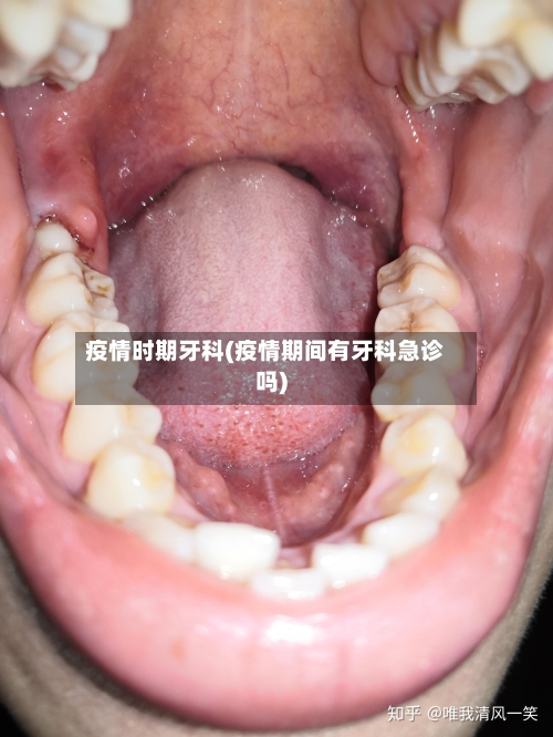 疫情时期牙科(疫情期间有牙科急诊吗)-第2张图片